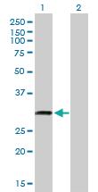 Anti-TPGS2 Mouse Polyclonal Antibody