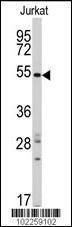 Anti-SMYD5 Rabbit Polyclonal Antibody (Biotin)