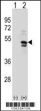 Anti-USP14 Rabbit Polyclonal Antibody (APC (Allophycocyanin))