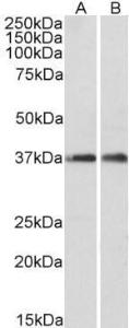 Anti-ARPC1A Antibody (A82827) (0.1 µg/ml) staining of fetal Mouse Brain (A) and adult Rat Brain (B) lysates (35 µg protein in RIPA buffer). Primary incubation was 1 hour. Detected by chemiluminescence