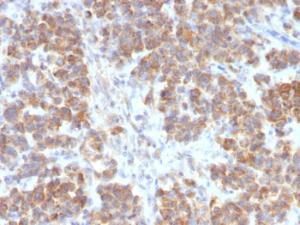 Antibody anti-TNFS15 VEGI2052R BSA 100 µg