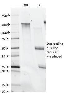 SDS-PAGE analysis of Anti-Histone H1 Antibody [SPM256] under non-reduced and reduced conditions; showing intact IgG and intact heavy and light chains, respectively. SDS-PAGE analysis confirms the integrity and purity of the antibody.