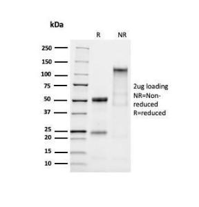 SDS-PAGE analysis of Anti-MUC2 Antibody [mlP/2970R] under non-reduced and reduced conditions; showing intact IgG and intact heavy and light chains, respectively. SDS-PAGE analysis confirms the integrity and purity of the antibody