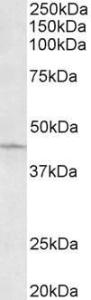 Anti-ARPC1A Antibody (A82827) (0.3 µg/ml) staining of HeLa lysate (35 µg protein in RIPA buffer). Primary incubation was 1 hour. Detected by chemiluminescence