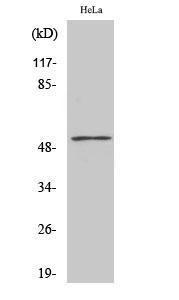 Western blot analysis of various cells using Anti-PFKFB1 + PFKFB4 Antibody