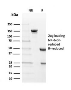 SDS-PAGE analysis of Anti-Transthyretin Antibody [TTR/4292] under non-reduced and reduced conditions; showing intact IgG and intact heavy and light chains, respectively. SDS-PAGE analysis confirms the integrity and purity of the antibody