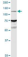 Anti-ARHGEF1 Rabbit Polyclonal Antibody