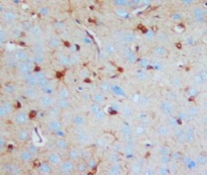 Anti-S-100 (beta-subunit) Mouse Monoclonal Antibody [clone: SA-12]