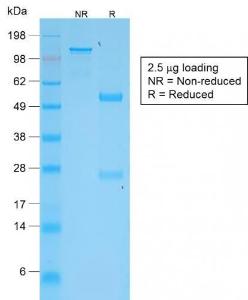 Antibody anti-TNFS15 VEGI2052R BSA 100 µg