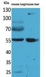 Western blot analysis of mouse lung, mouse liver cells using Anti-ALDH1A1 Antibody