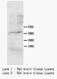 Anti-Smad4 Mouse Monoclonal Antibody [clone: IMD-89]