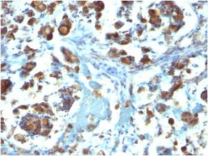 Anti-MUC3 antibody