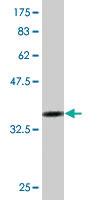 Anti-TSSK1 Mouse Monoclonal Antibody [clone: 4F12]