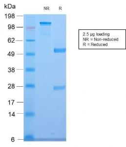 SDS-PAGE analysis of Anti-CELA3B Antibody [CELA3B/2810R] under non-reduced and reduced conditions; showing intact IgG and intact heavy and light chains, respectively. SDS-PAGE analysis confirms the integrity and purity of the antibody