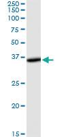 Anti-THUMPD1 Mouse Monoclonal Antibody [clone: 4A11]