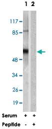 Anti-AKT1 Rabbit Polyclonal Antibody