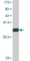 Anti-MCPH1 Mouse Polyclonal Antibody