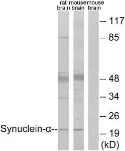 Western blot analysis of lysates from rat brain and mouse brain cells using Anti-Synuclein-alpha Antibody. The right hand lane represents a negative control, where the antibody is blocked by the immunising peptide.