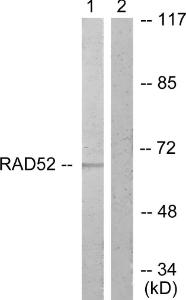 Western blot analysis of lysates from A549 cells, treated with EGF 200ng/ml 30' using Anti-DRP-2 Antibody. The right hand lane represents a negative control, where the antibody is blocked by the immunising peptide