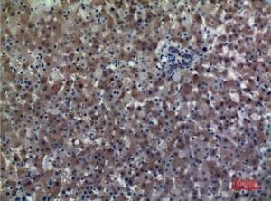 Immunohistochemical analysis of paraffin-embedded human liver using Anti-ALDH1A1 Antibody