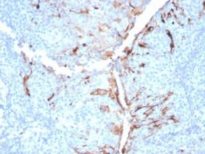 Immunohistochemical analysis of formalin-fixed, paraffin-embedded human tonsil using Anti-Mesothelin Antibody [MSLN/3384]