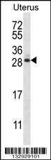 Anti-ARL8A Rabbit Polyclonal Antibody