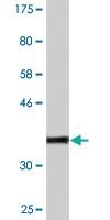 Anti-MAP3K7 Mouse Monoclonal Antibody [clone: 3C9]