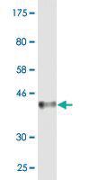 Anti-MCPH1 Mouse Monoclonal Antibody [clone: 6F5]