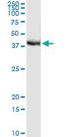 Anti-FRG1 Antibody Pair