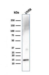 Western blot analysis of liver tissue lysate using Anti-Transthyretin Antibody [TTR/4292]