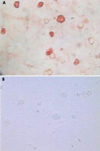 Anti-Kaposi's sarcoma-associated herpesvirus K8a Mouse Monoclonal Antibody [clone: 8C12G10G1]