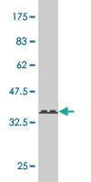 Anti-TSSK1 Mouse Monoclonal Antibody [clone: 2E8]