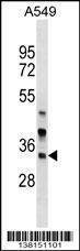 Anti-ARMC1 Rabbit Polyclonal Antibody (APC (Allophycocyanin))