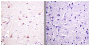 Immunohistochemical analysis of paraffin-embedded human brain tissue using Anti-DRP-2 Antibody. The right hand panel represents a negative control, where the antibody was pre-incubated with the immunising peptide