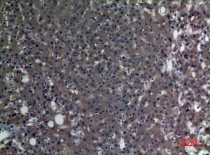 Immunohistochemical analysis of paraffin-embedded human liver using Anti-ALDH1A1 Antibody