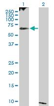 Anti-MAP2 Rabbit Polyclonal Antibody