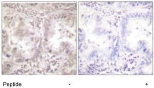 Anti-AKT1 Rabbit Polyclonal Antibody