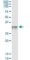 Anti-FRG1 Antibody Pair