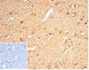 Anti-AKR1B1 antibody