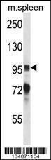 Anti-PTK2B Rabbit Polyclonal Antibody (FITC (Fluorescein Isothiocyanate))