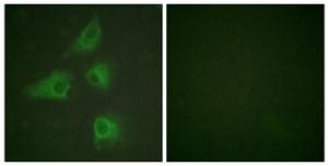 Immunofluorescence analysis of HeLa cells using Anti-DRP-2 Antibody. The right hand panel represents a negative control, where the antibody was pre-incubated with the immunising peptide