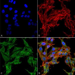 Immunocytochemistry/Immunofluorescence analysis of human colon carcinoma cell line (RKO), fixed in 4% formaldehyde for 15 min at room temperature, using Anti-ATG4C Antibody (A304856), at 1:100 for 60 minutes at room temperatur