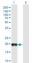 Anti-MAP4 Mouse Monoclonal Antibody [clone: 7C9]