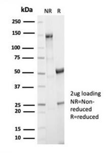 Anti-AKR1B1 antibody