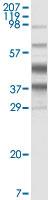 Anti-Kaposi's sarcoma-associated herpesvirus K8a Mouse Monoclonal Antibody [clone: 8C12G10G1]