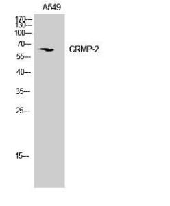 Western blot analysis of mouse brain cells using Anti-DRP-2 Antibody