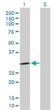 Anti-PCSK1N Mouse Polyclonal Antibody