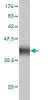 Anti-ZNF345 Mouse Monoclonal Antibody [clone: 6G10]