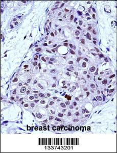 Anti-MYB Rabbit Polyclonal Antibody (FITC (Fluorescein Isothiocyanate))