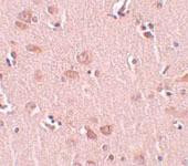 Anti-PLEKHM2 Rabbit Polyclonal Antibody